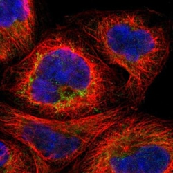 MTIF2 Antibody, Novus Biologicals 0.1mL; Unlabeled:Antibodies, Polyclonal